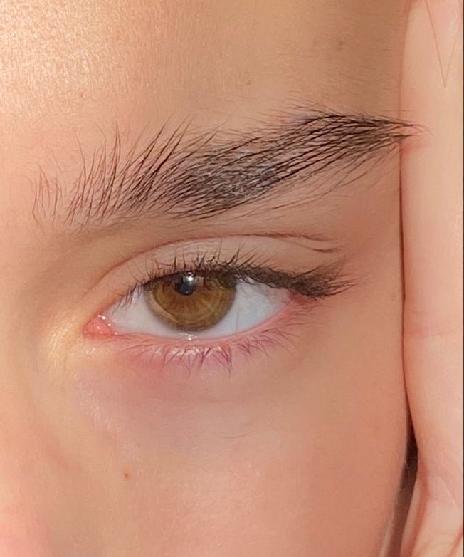 6 Naturopath Tips to combat puffy eyes and dark circles.