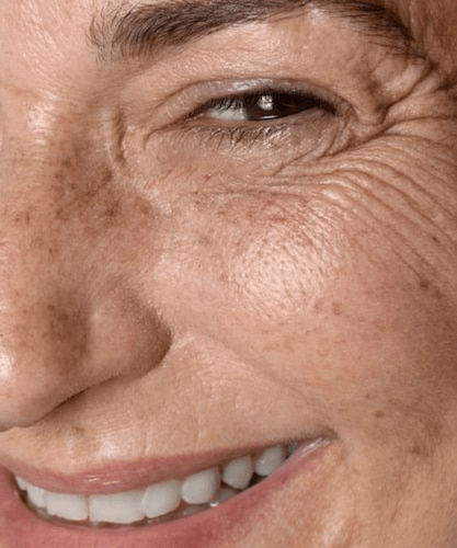 Advanced Natural Anti-Aging Hacks: Topical and Ingestible Solutions for Youthful Skin