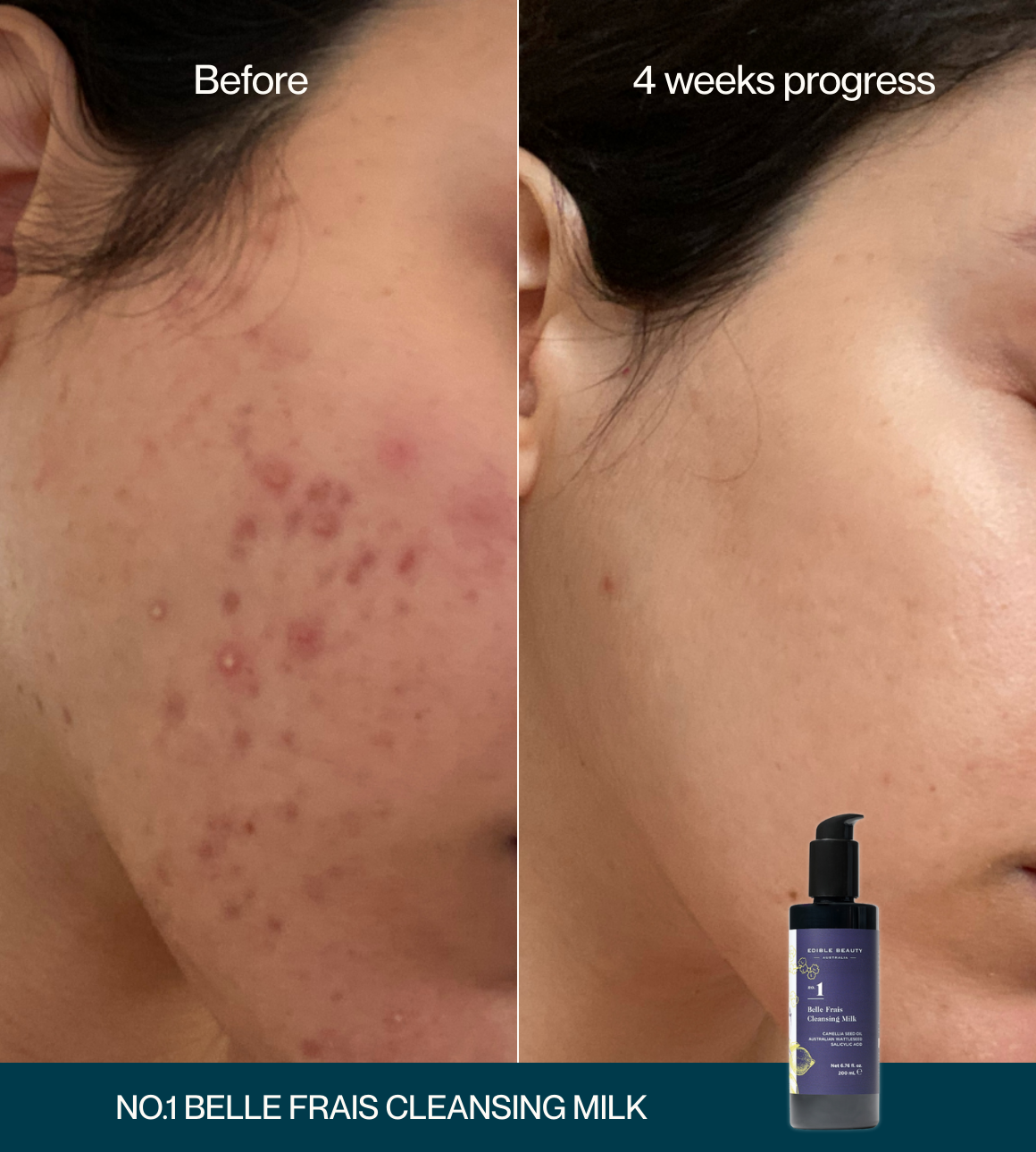 No.1 Belle Frais Facial Cleansing Milk - Edible Beauty Australia