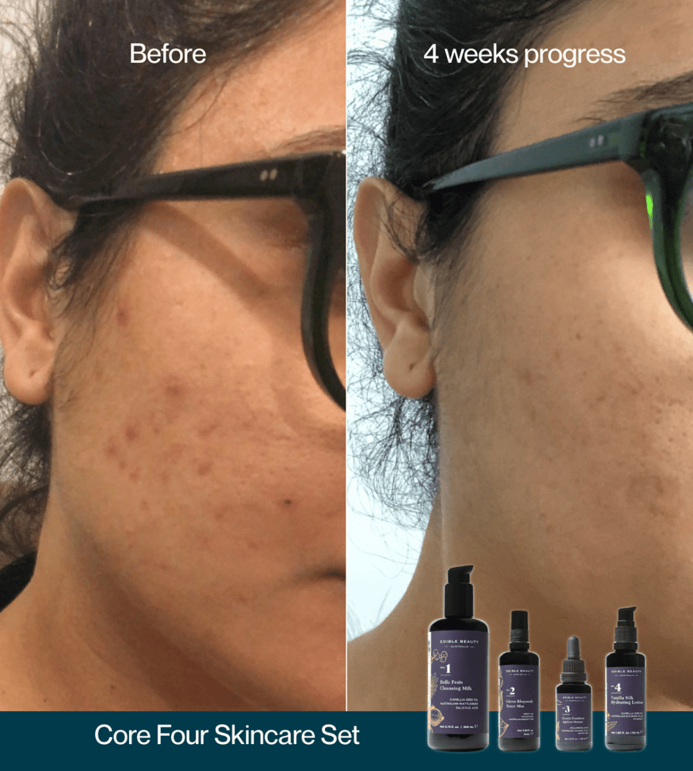 Core Four Starter Set