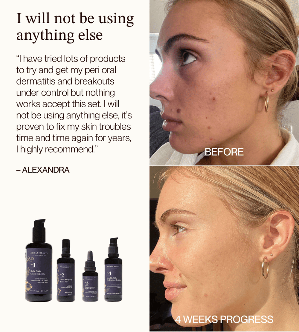 Core Four Starter Set