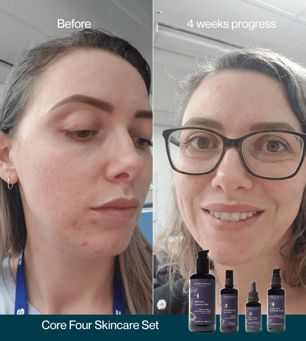 Core Four Starter Set