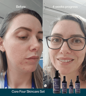 Core Four Starter Set