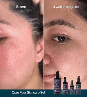 Core Four Starter Set