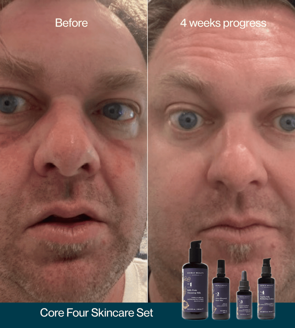 Core Four Starter Set