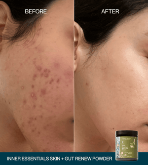 Inner Essentials – Skin + Gut Renew Powder