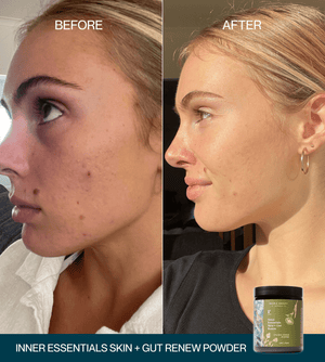 Inner Essentials – Skin + Gut Renew Powder