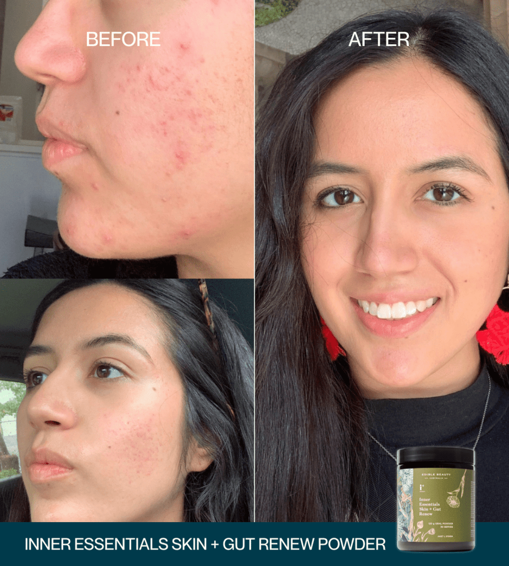 Inner Essentials – Skin + Gut Renew Powder