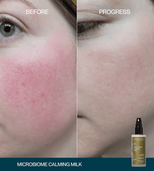 Microbiome Calming Milk Booster Serum