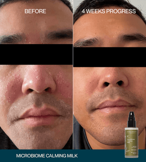 Microbiome Calming Milk Booster Serum