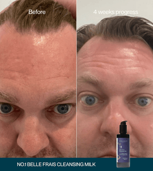 No.1 Belle Frais Cleansing Milk Sampler Tube – 20mL