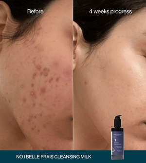 No.1 Belle Frais Cleansing Milk Sampler Tube – 20mL