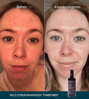 No.2 Citrus Rhapsody Toner Mist - 15mL Sampler