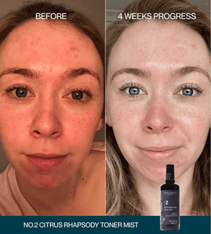 No.2 Citrus Rhapsody Toner Mist Double Deal