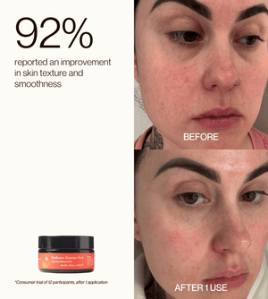 Radiance Enzyme Peel