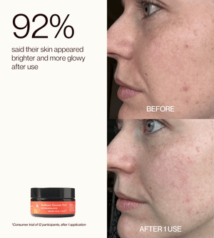 Radiance Enzyme Peel