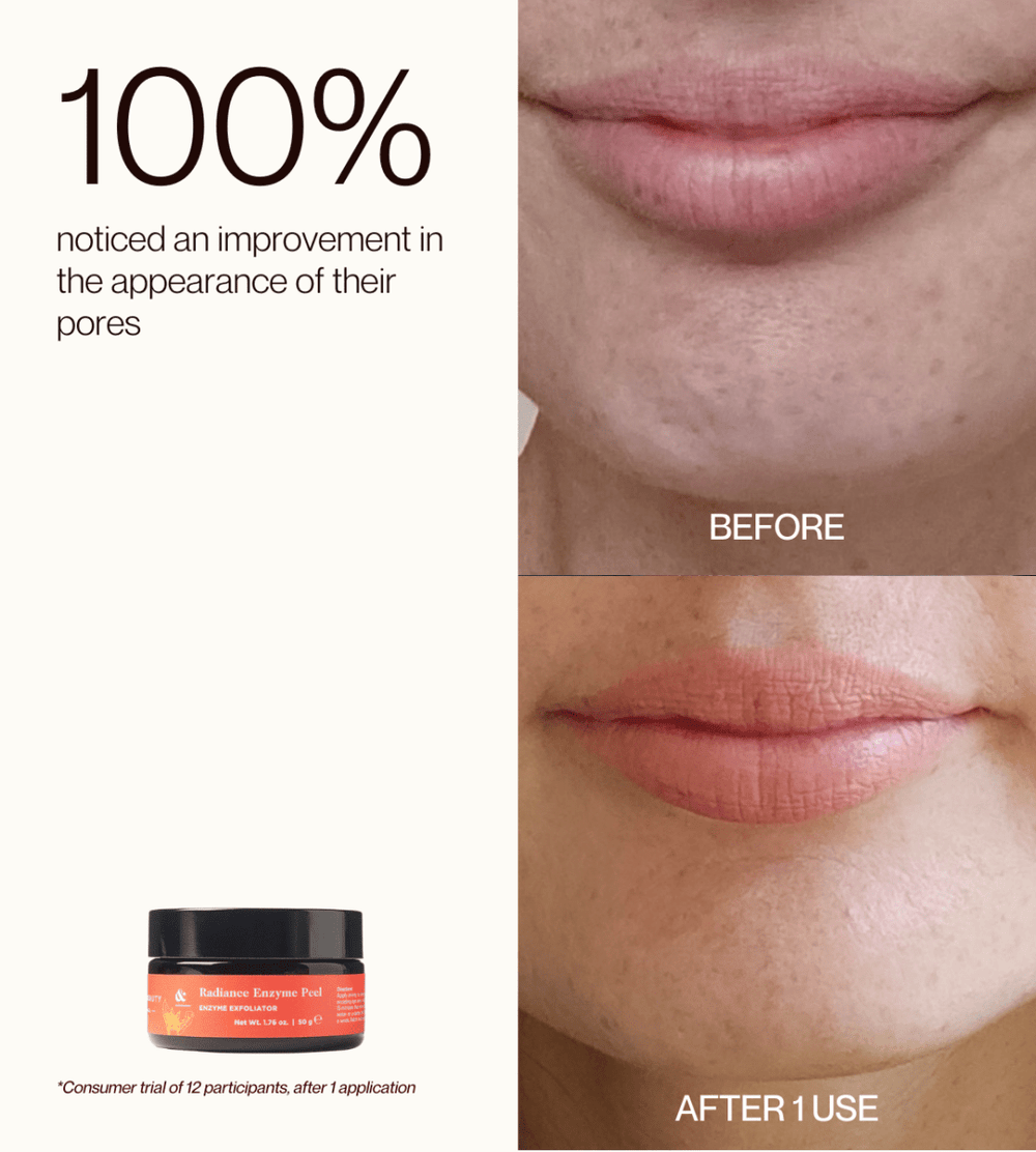 Radiance Enzyme Peel