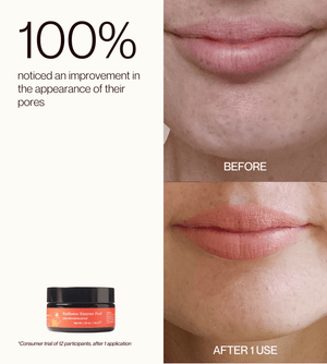 Radiance Enzyme Peel