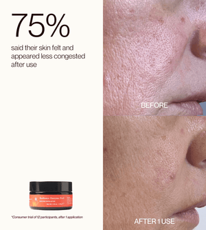 Radiance Enzyme Peel