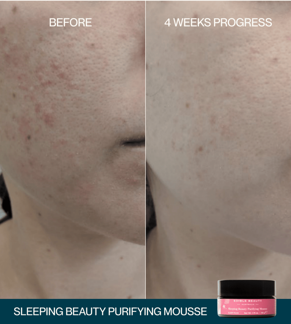 & Sleeping Beauty Purifying Mousse - Sleep Mask