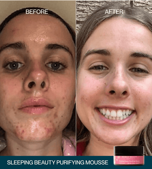 & Sleeping Beauty Purifying Mousse - Sleep Mask